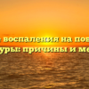 Влияние воспаления на повышение температуры: причины и механизмы