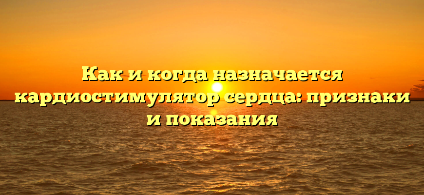 Как и когда назначается кардиостимулятор сердца: признаки и показания