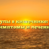Дивертикулы в кишечнике: причины, симптомы и лечение
