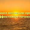 Дисфункция яичников: причины и эффективное лечение
